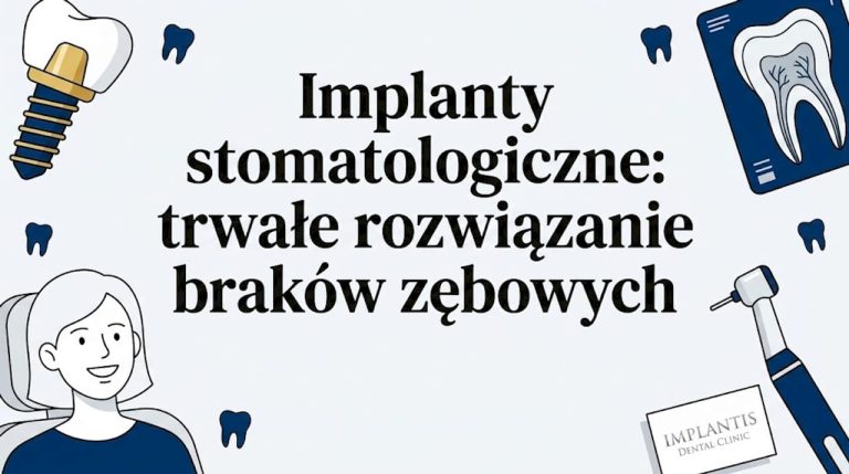 Ilustracja wektorowa na okładkę: implant stomatologiczny w nowoczesnym, płaskim stylu